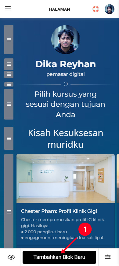 Mengetuk Tambahkan blok di editor Taplink